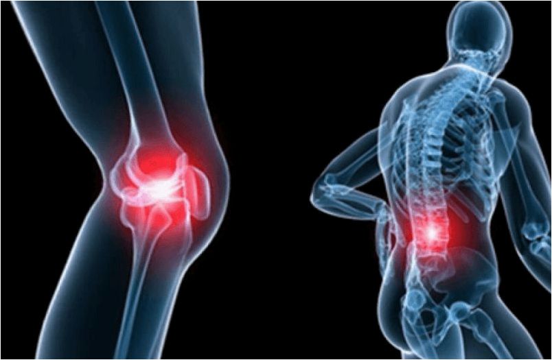 (остеоартроз, симптомы, степени, лечение) Остеоартроз: симптомы, степени, лечение